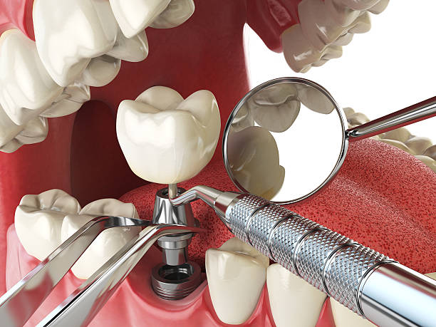 Best Orthodontic Emergency Dentist in Wendell, NC